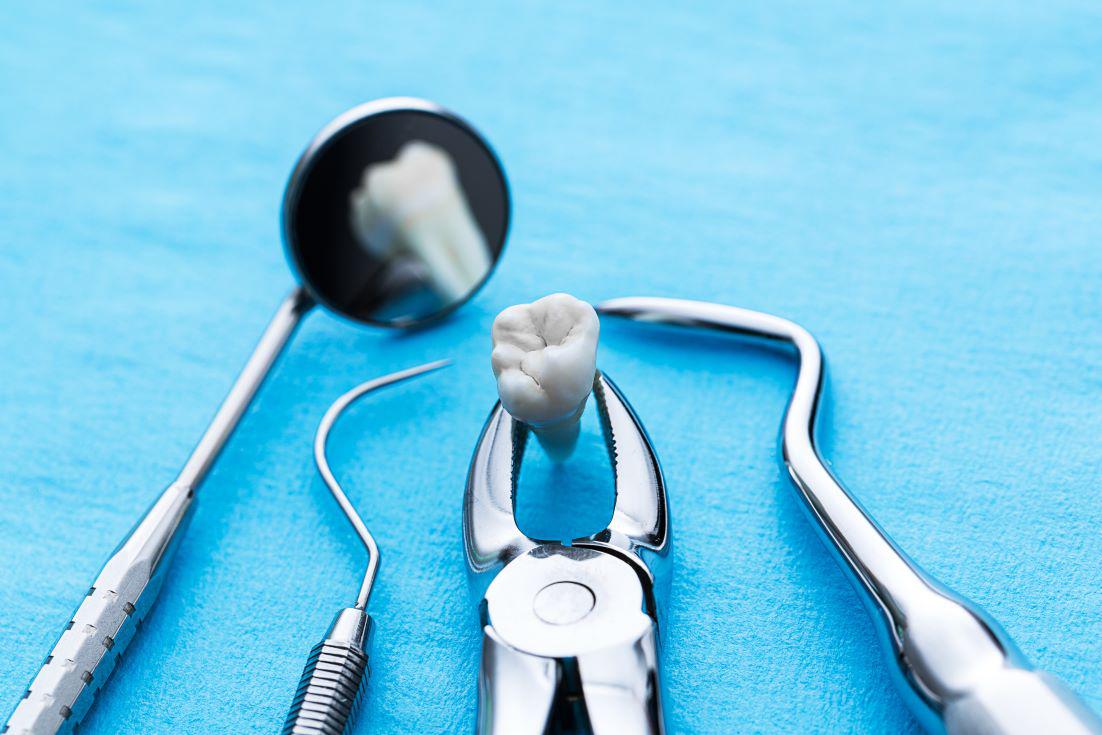 Patient receiving specialized tooth extraction care